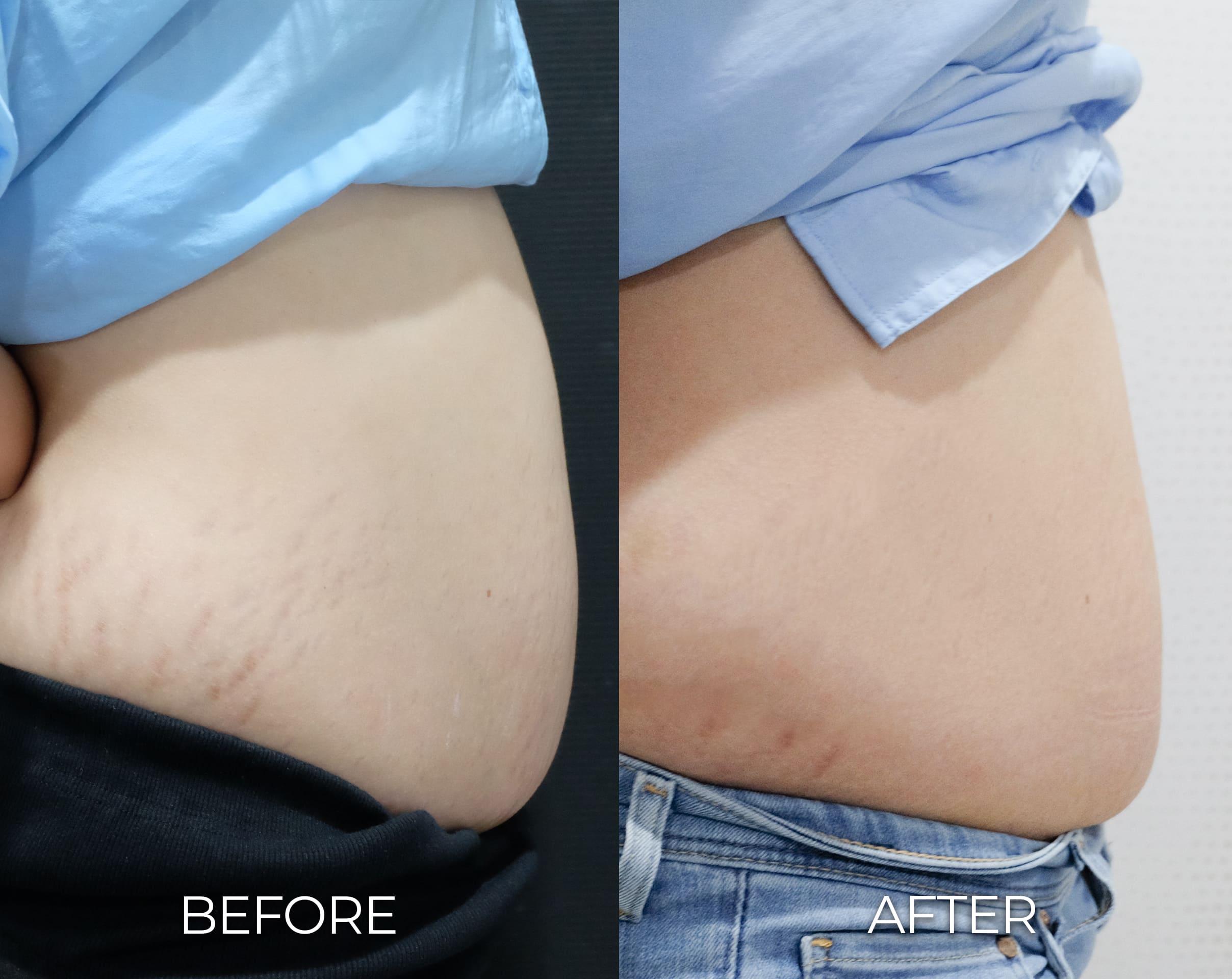 LIPO 3